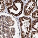 SUCLA2 Antibody in Immunohistochemistry (IHC)