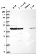 SUCLA2 Antibody in Western Blot (WB)