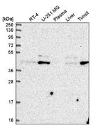 ZDHHC16 Antibody in Western Blot (WB)