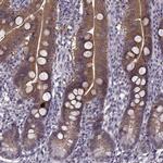 ACOT11 Antibody in Immunohistochemistry (IHC)