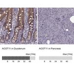 ACOT11 Antibody