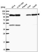 C15orf39 Antibody in Western Blot (WB)