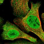 N4BP2 Antibody in Immunocytochemistry (ICC/IF)