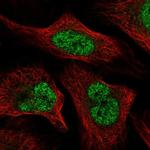 WAC Antibody in Immunocytochemistry (ICC/IF)