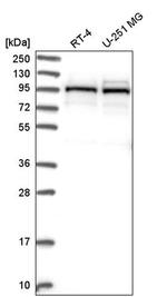 LAR4B Antibody in Western Blot (WB)