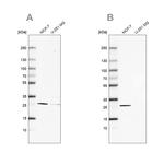 FAHD1 Antibody in Western Blot (WB)