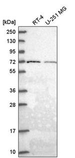 GGA2 Antibody in Western Blot (WB)