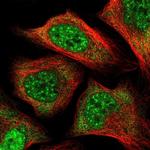 PCBP1 Antibody in Immunocytochemistry (ICC/IF)