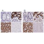 GLYAT Antibody in Immunohistochemistry (IHC)