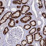 GLYAT Antibody in Immunohistochemistry (IHC)