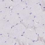 GLYAT Antibody in Immunohistochemistry (IHC)