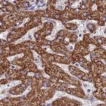 GLYAT Antibody in Immunohistochemistry (IHC)