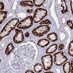 GLYAT Antibody in Immunohistochemistry (IHC)