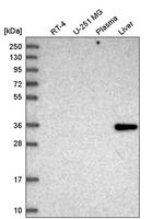 GLYAT Antibody in Western Blot (WB)