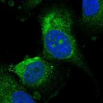 UTP15 Antibody in Immunocytochemistry (ICC/IF)