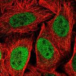 KIF23 Antibody in Immunocytochemistry (ICC/IF)