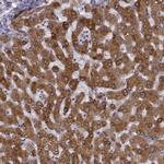 Growth Hormone Receptor Antibody in Immunohistochemistry (IHC)