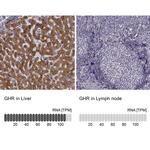 Growth Hormone Receptor Antibody