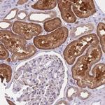 COPG Antibody in Immunohistochemistry (IHC)