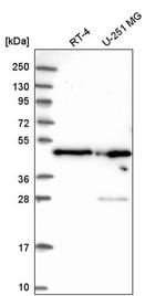 RDBP Antibody in Western Blot (WB)