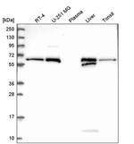 RETSAT Antibody in Western Blot (WB)