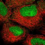 HOXB2 Antibody in Immunocytochemistry (ICC/IF)