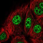 KID Antibody in Immunocytochemistry (ICC/IF)