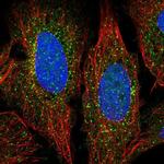 ADAMTS7 Antibody in Immunocytochemistry (ICC/IF)