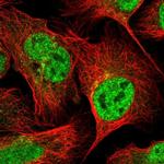 GOSR2 Antibody in Immunocytochemistry (ICC/IF)