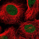 TAF11 Antibody in Immunocytochemistry (ICC/IF)