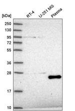 TAF11 Antibody in Western Blot (WB)