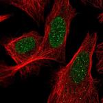 ACD Antibody in Immunocytochemistry (ICC/IF)