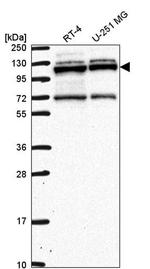 RBM15 Antibody in Western Blot (WB)