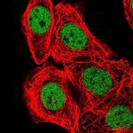 BCL7B Antibody in Immunocytochemistry (ICC/IF)