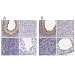 GPR64 Antibody in Immunohistochemistry (IHC)