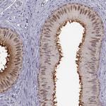 GPR64 Antibody in Immunohistochemistry (IHC)