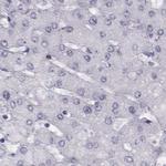 GPR64 Antibody in Immunohistochemistry (IHC)