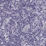 GPR64 Antibody in Immunohistochemistry (IHC)