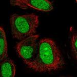 TRMT6 Antibody in Immunocytochemistry (ICC/IF)