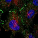 53BP2 Antibody in Immunocytochemistry (ICC/IF)