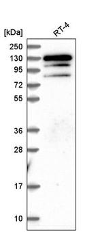 KRBA1 Antibody in Western Blot (WB)