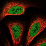 TREF1 Antibody in Immunocytochemistry (ICC/IF)