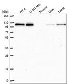 TREF1 Antibody in Western Blot (WB)