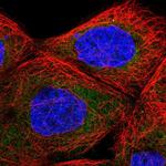 TBL2 Antibody in Immunocytochemistry (ICC/IF)