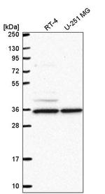 MAK10 Antibody in Western Blot (WB)