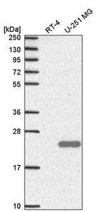 SPACA9 Antibody in Western Blot (WB)