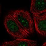 NOM1 Antibody in Immunocytochemistry (ICC/IF)