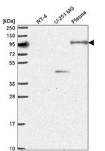 NOM1 Antibody in Western Blot (WB)