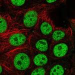 BCL7C Antibody in Immunocytochemistry (ICC/IF)