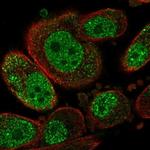 SETD6 Antibody in Immunocytochemistry (ICC/IF)